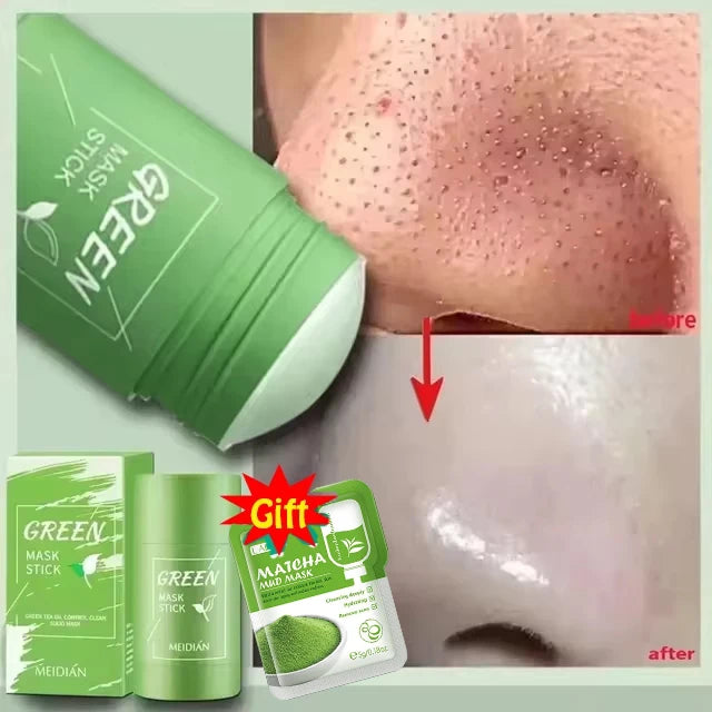 Remove Blackhead Mud Mask