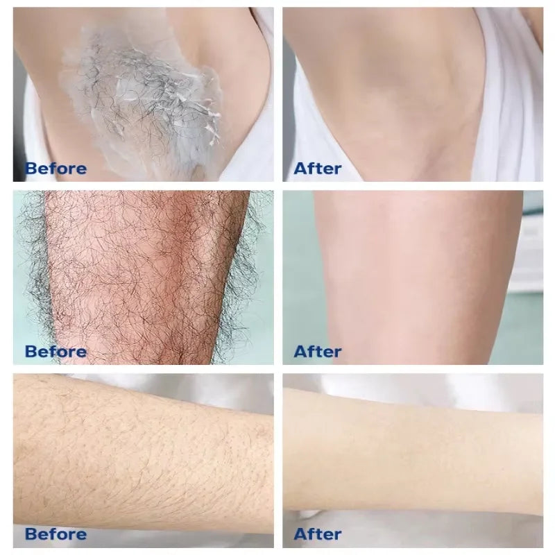 Sakura Hair Removal of Arm Armpit Legs,for Men Woman